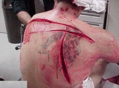 للكبار فقط +21 صورة - تعذيب الاسرى في سوريا على يد شبيحة النظام السوري